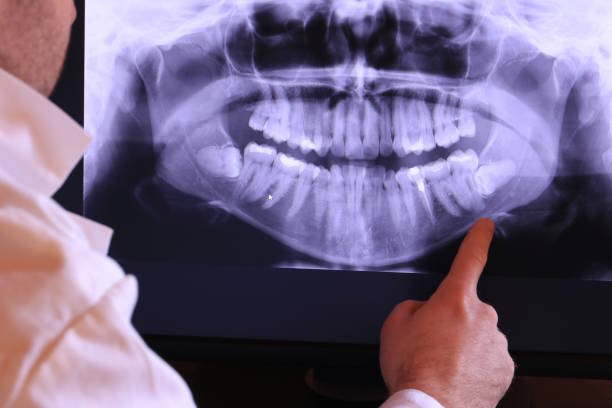 Best Teeth Whitening  in Amherst, OH